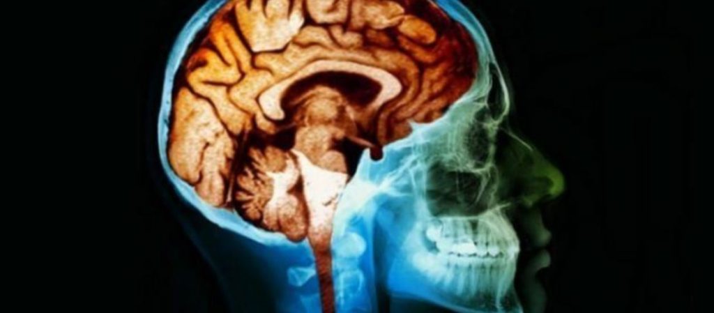 Guzy mózgu i funkcje poznawcze